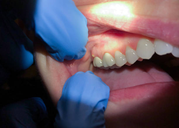 Best Same-Day Emergency Dental Services in Marysville, OH