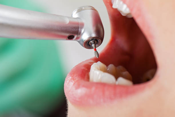 Best Pediatric Emergency Dentist in Marysville, OH